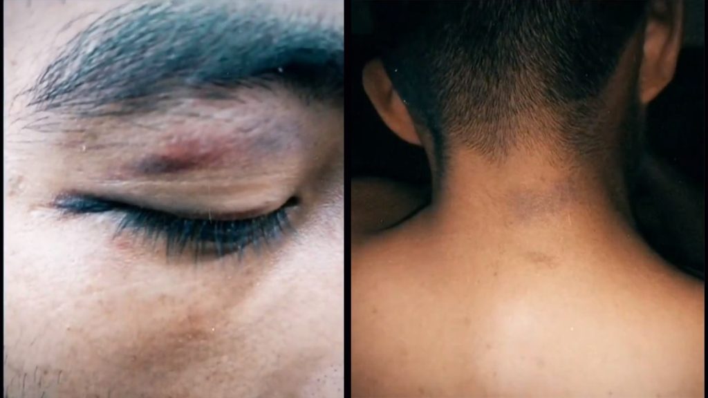 lesiones de trailero causadas por policias