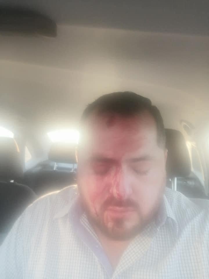 ALERTAN POR PERSONA QUE TIRA PIEDRAS A VIAJEROS EN AUTOPISTA