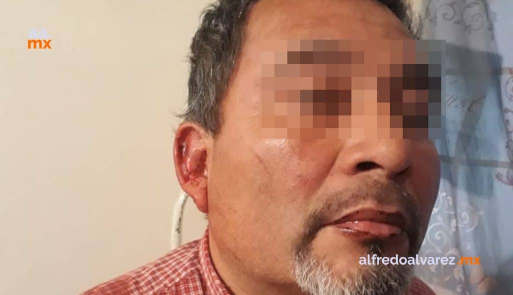 JOVENCITO LLEGA A CASA Y LESIONA A SU PADRE