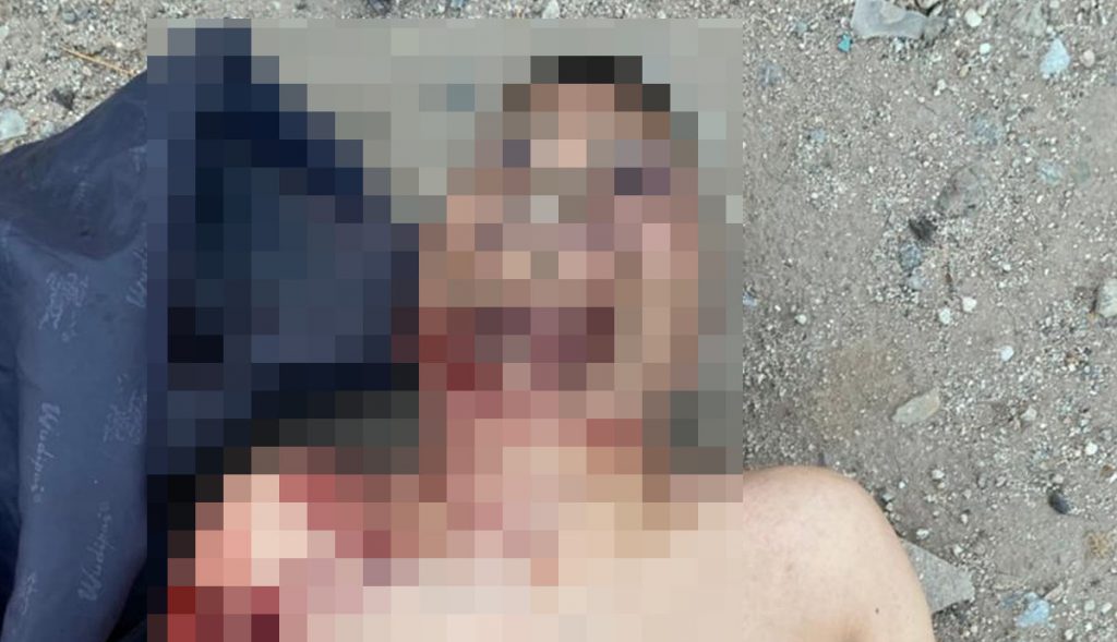 MATAN A HOMBRE Y LESIONAN A DOS, UNO DE GRAVEDAD