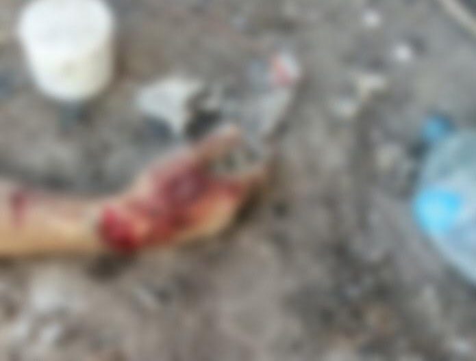 LO MATAN EN VIVIENDA ABANDONADA; A OTRO LO ATROPELLAN