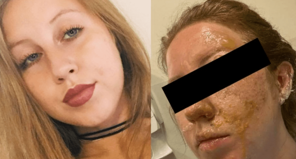 MESERO QUEMA A TURISTA ESTADOUNIDENSE EN BAR DE CANCúN MESERO QUEMA A TURISTA ESTADOUNIDENSE EN BAR DE CANCúN