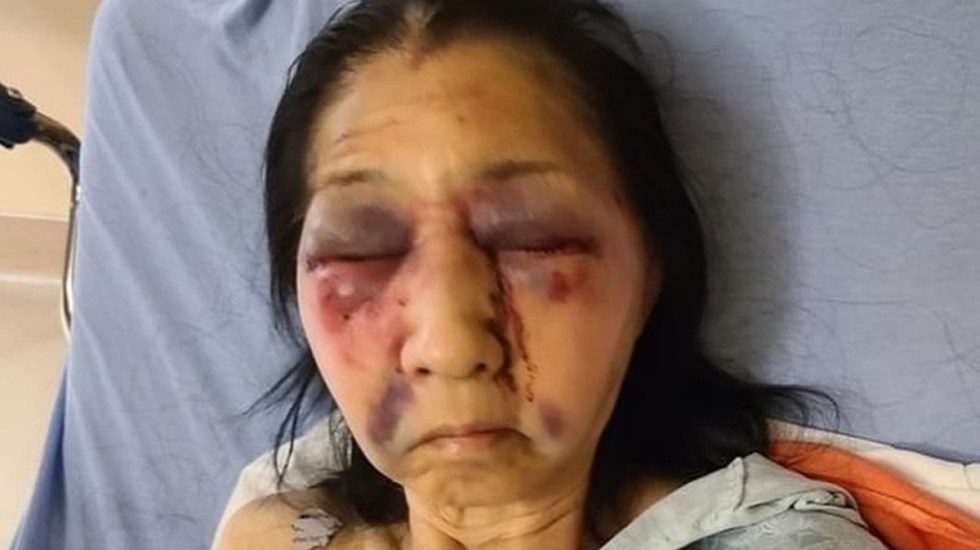 GOLPEAN BRUTALMENTE A ADULTA MAYOR MEXICANA EN LOS ÁNGELES