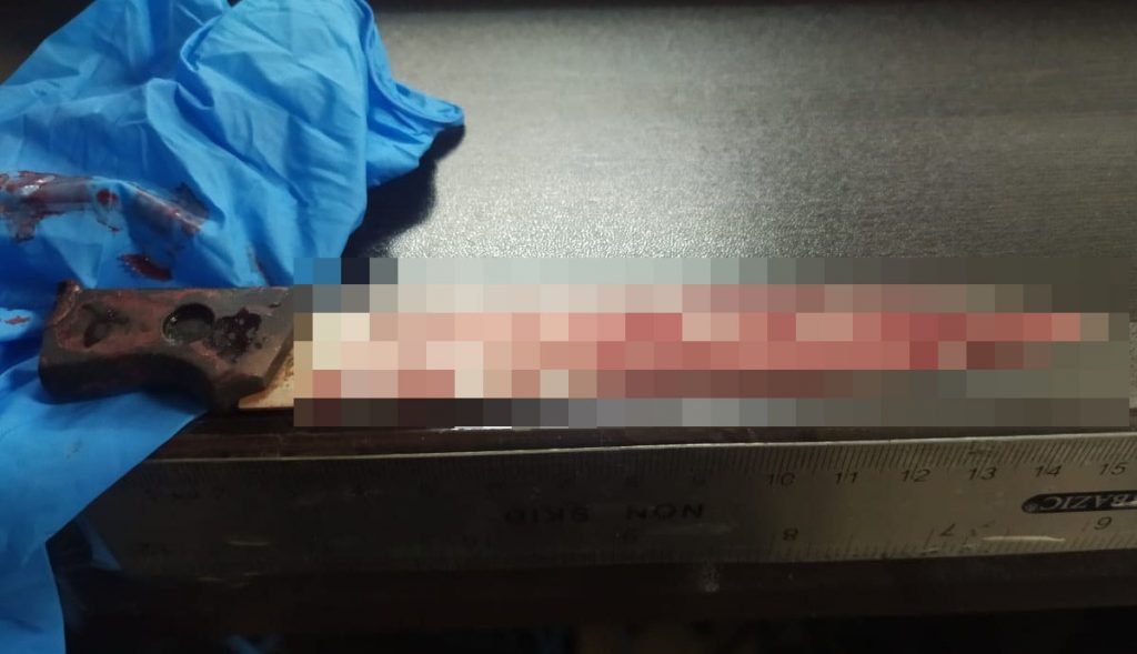 RIñA CON CUCHILLO DEJA UN HERIDO; CAE AGRESOR