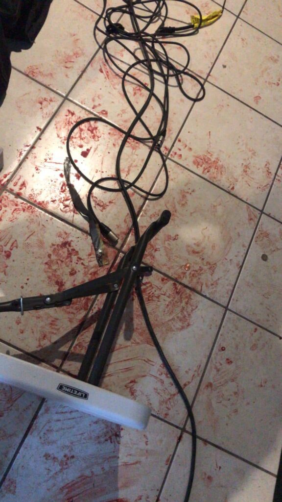 ASALTAN Y ATACAN BRUTALMENTE A GRUPO MUSICAL EN TIJUANA
