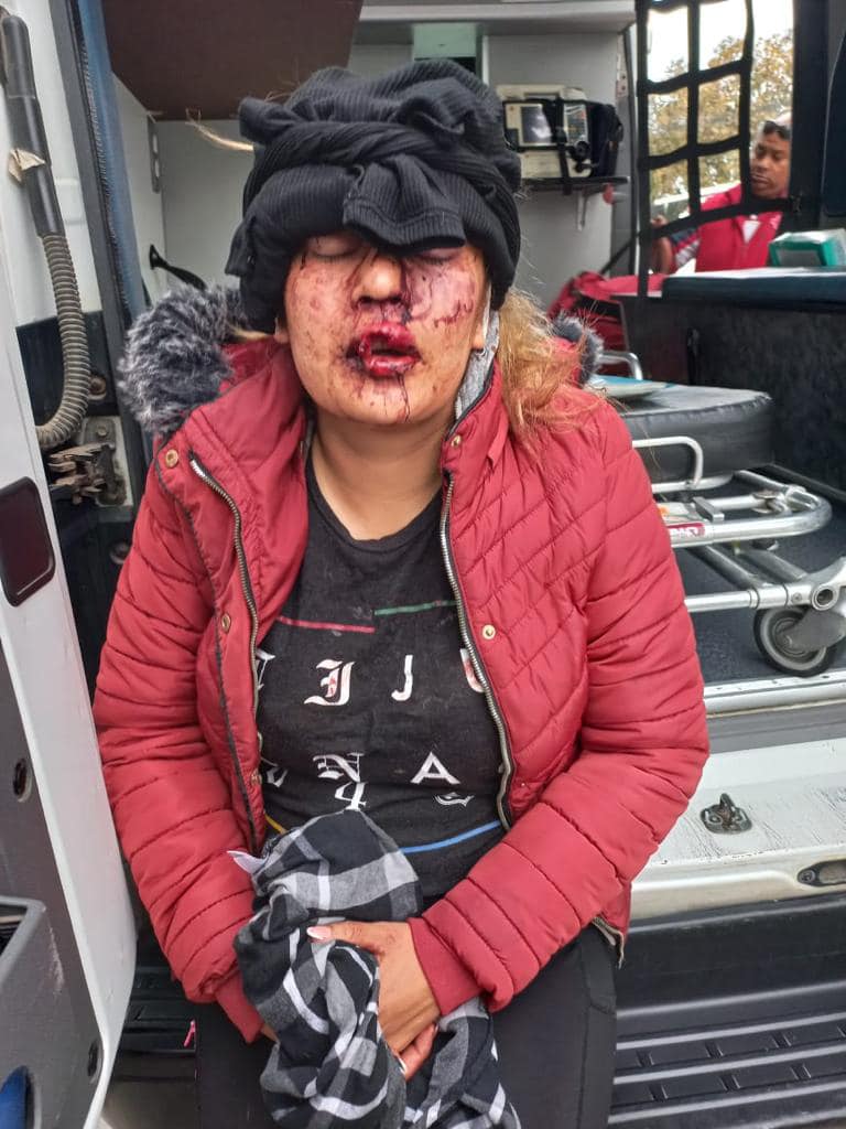 ASALTAN Y ATACAN BRUTALMENTE A GRUPO MUSICAL EN TIJUANA
