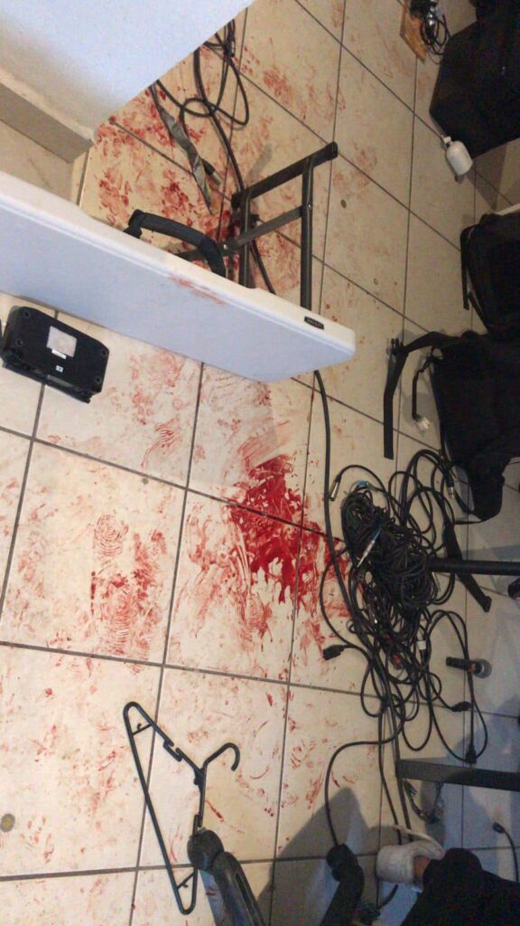 ASALTAN Y ATACAN BRUTALMENTE A GRUPO MUSICAL EN TIJUANA