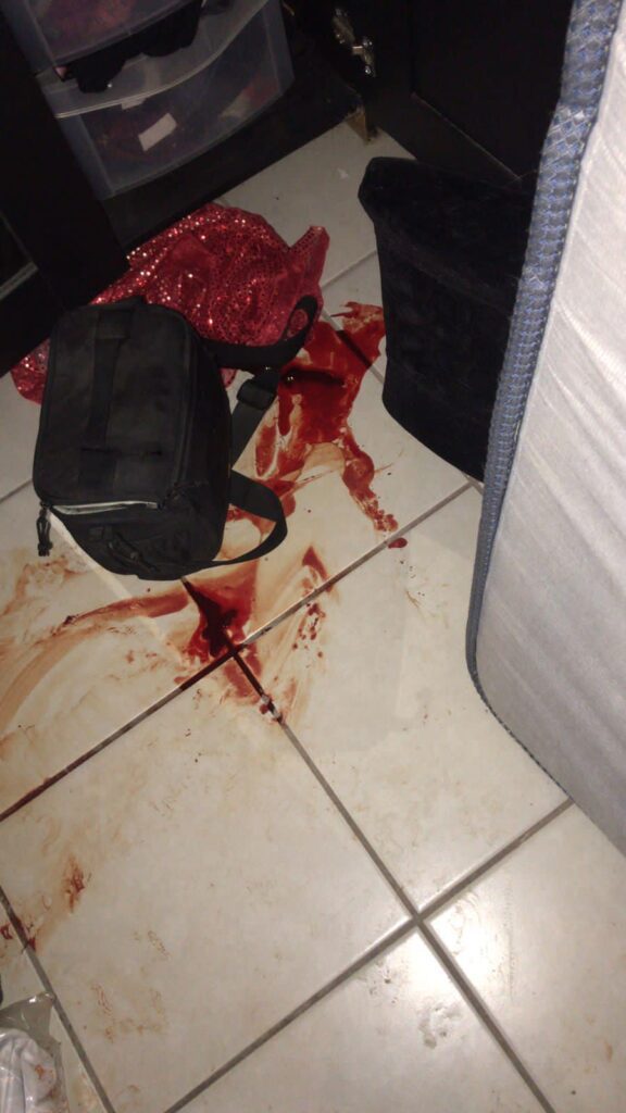 ASALTAN Y ATACAN BRUTALMENTE A GRUPO MUSICAL EN TIJUANA