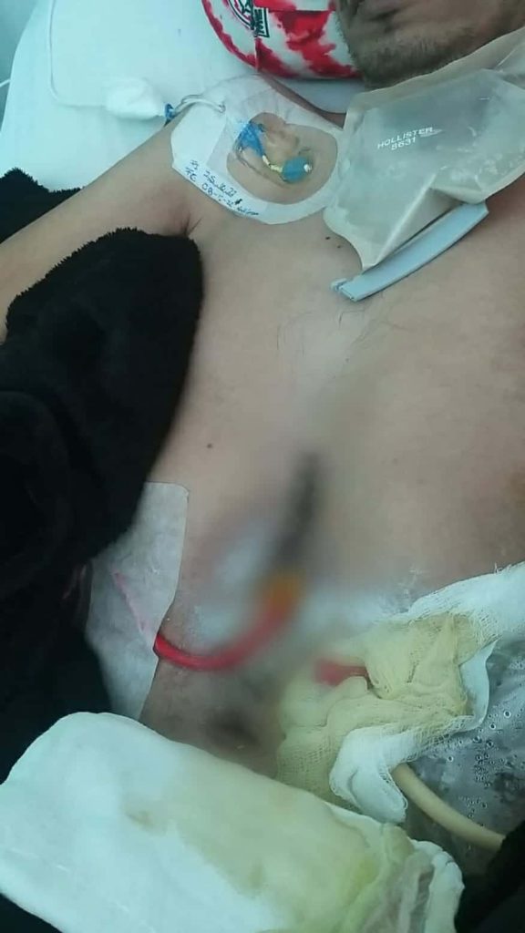 Familia denuncia negligencia médica en la clínica 1; paciente empeora