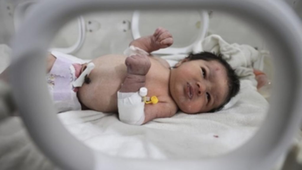 Aya, la bebé milagro ya fue adoptada