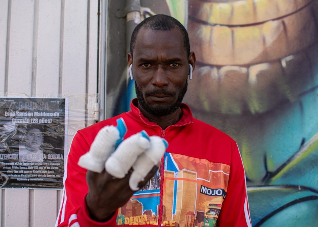 Periodista haitiano sufre accidente laboral y la empresa no lo apoya