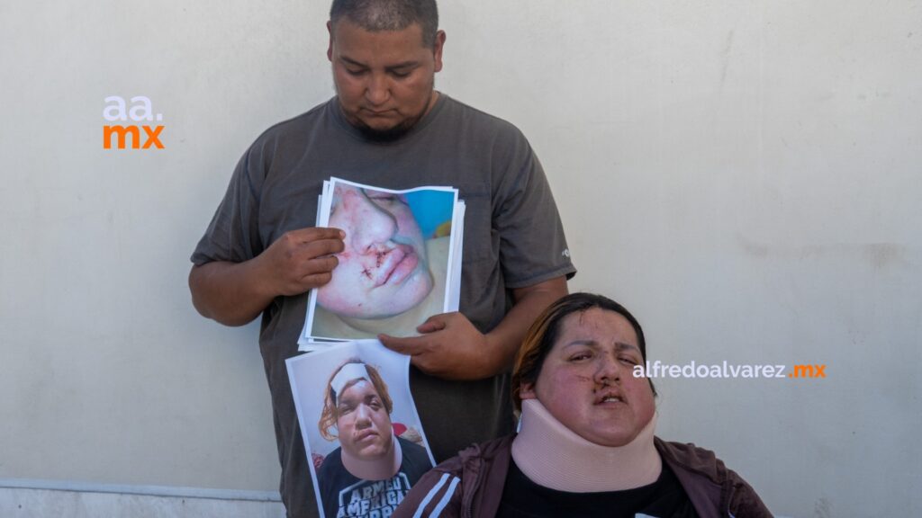 Familia denuncia a Circo de los Dinosaurios tras accidente que dejó a madre en silla de ruedas
