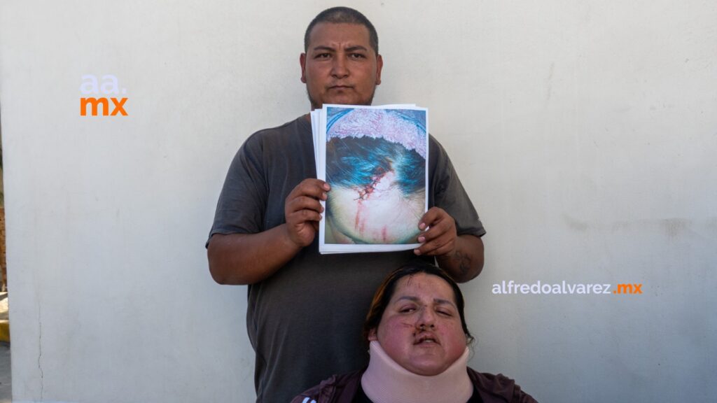 Familia denuncia a Circo de los Dinosaurios tras accidente que dejó a madre en silla de ruedas
