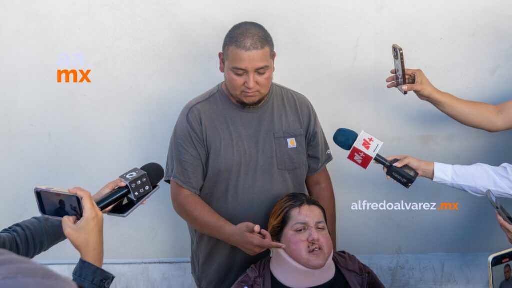 Familia denuncia a Circo de los Dinosaurios tras accidente que dejó a madre en silla de ruedas