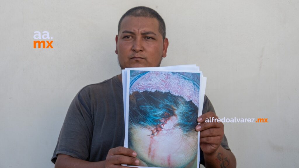 Familia denuncia a Circo de los Dinosaurios tras accidente que dejó a madre en silla de ruedas