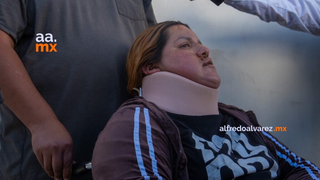 Familia denuncia a Circo de los Dinosaurios tras accidente que dejó a madre en silla de ruedas